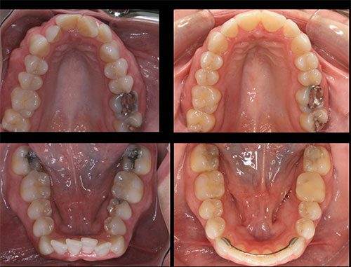 before and after